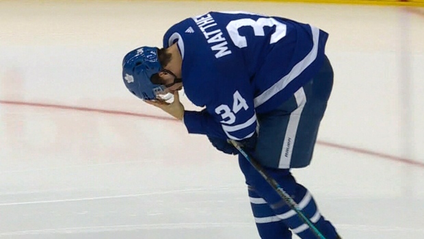 Auston Matthews injured