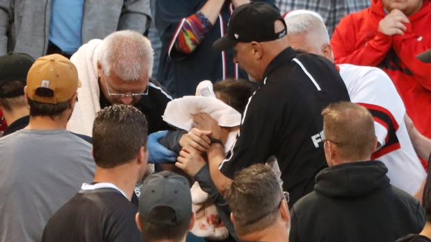 Fan gets hit with foul ball, The Canadian Press Fan gets hit with foul ball