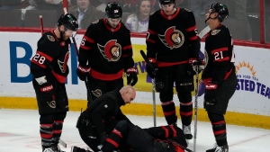 Sens F Brassard (broken fibula) has surgery, out long term