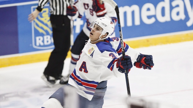 Auston Matthews, The Canadian Press Auston Matthews